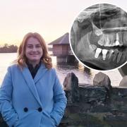 Woman awarded £10,000 after bad dental work in Bucks left her with infections