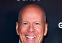 As Bruce Willis’ diagnosis is revealed – what is frontotemporal dementia?