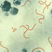 Number of scarlet fever infections in Buckinghamshire last week