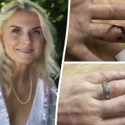 Woman rips wedding finger off before big day